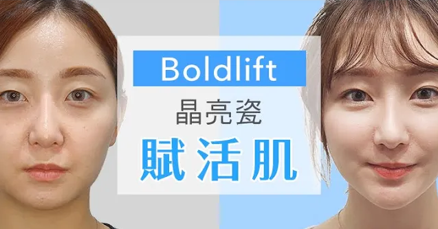 {Boldlift賦活肌} 案例－小薰