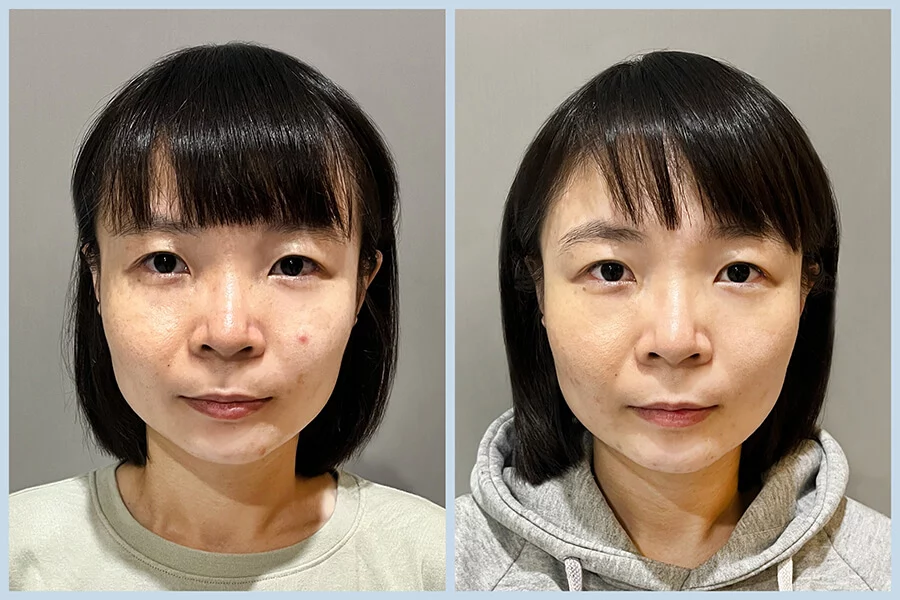 TC05_皮秒蜂巢BA (3)