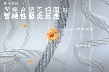 極光美學診所-美國音波2.0-暫時性發炎反應期