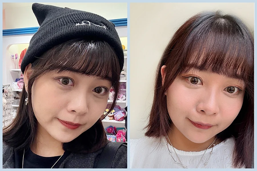 TP08_三效皮秒+膠原黑眼圈BA-09